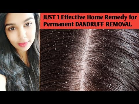 Watch more : https://www./channel/ucwq9trizypc331_3j8owucg?sub_confirmation=1 best home remedies for dandruff in tamil | removal treatmen...