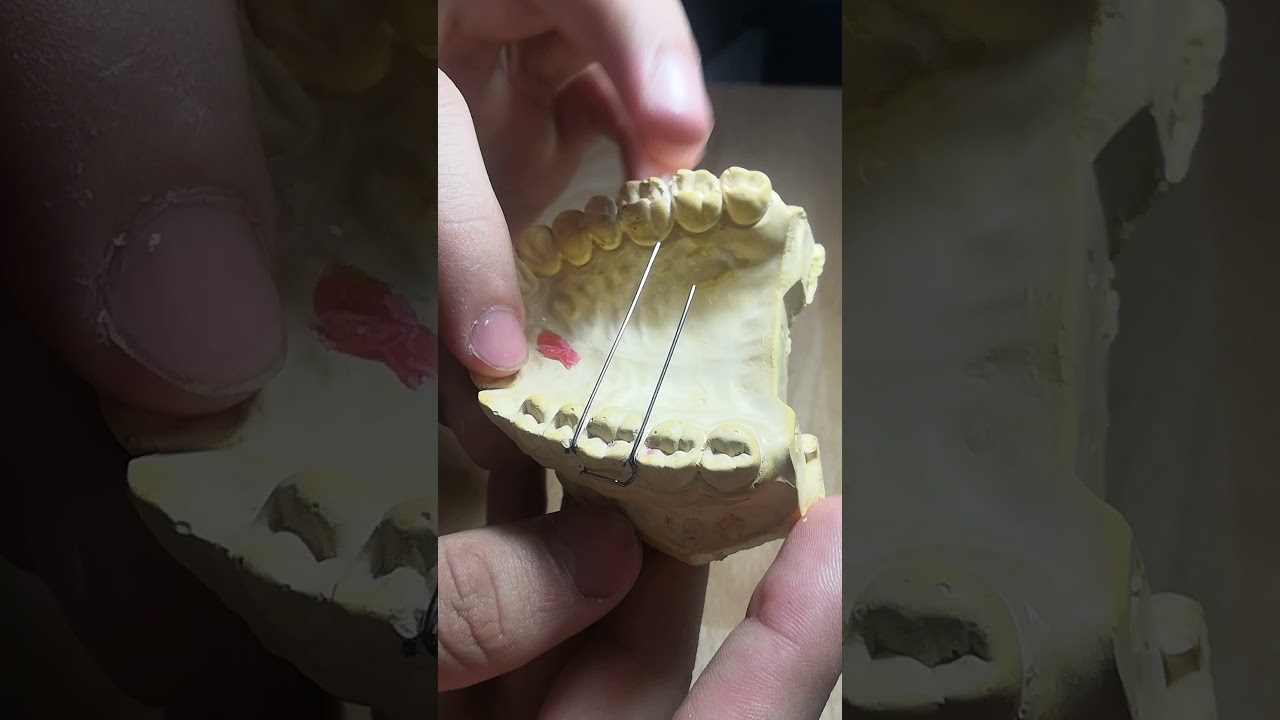 عمل adam clasp بخطوات سريعه وسهله