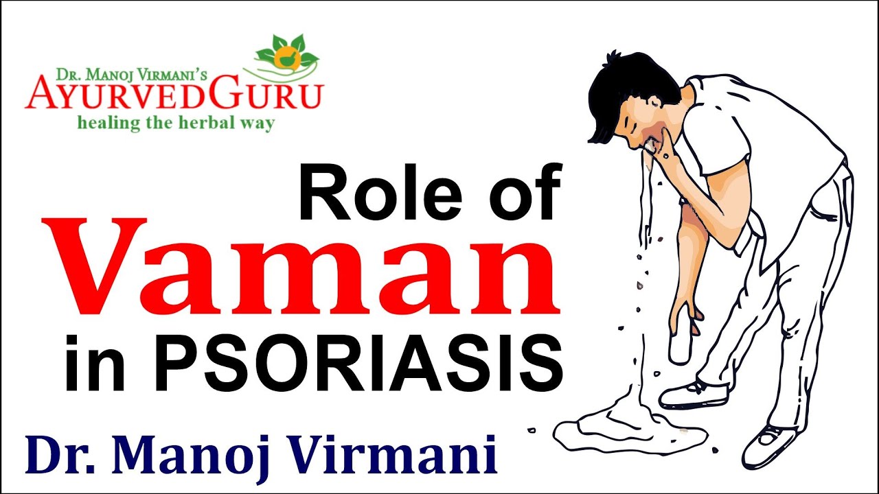 Vaman Roop Role of Vaman in psorasis - YouTube