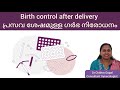 Birth control options after delivery Malayalam/ പ്രസവ ശേഷമുള്ള ഗർഭനിരോധന മാർഗ്ഗങ്ങൾ  #drchithra