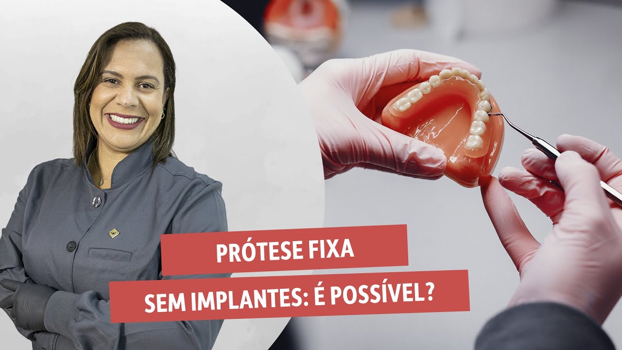 PRÓTESE FIXA SEM IMPLANTES: É POSSÍVEL?