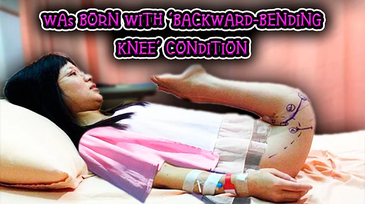 Chen Tuanzhi, 26, was born with 'backward-bending knee' condition - DayDayNews