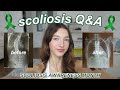  scoliosis qa   8 months post spinal fusion update