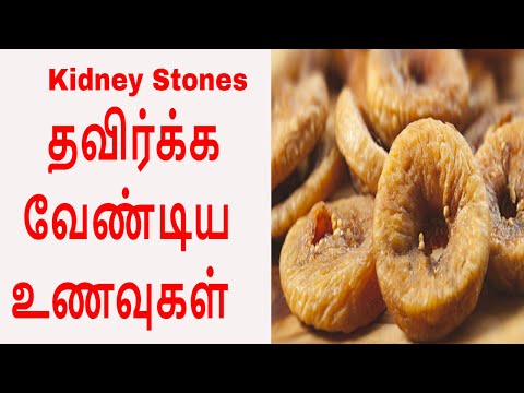 சிறுநீரக கற்கள் வராமல் இருக்க தவிர்க்க வேண்டிய உணவுகள்  | Kidney stone (Cure) foods to avoid