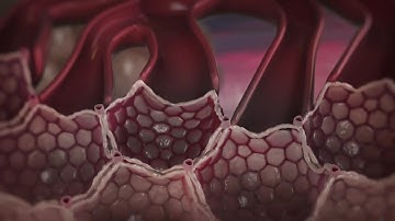 COPD - Chronic Obstructive Pulmonary Disease