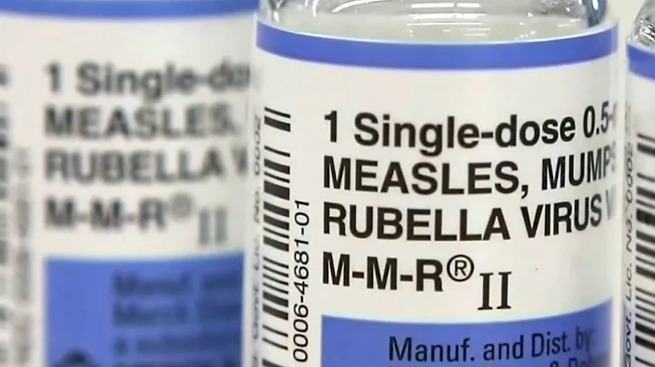 U.S. measles cases hit 25 year high