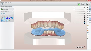 Digital Morning Repositioner Splint