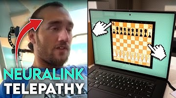 BREAKING: Neuralink VIDEO Shows Their First Patient Using Mind Control to Operate a PC!