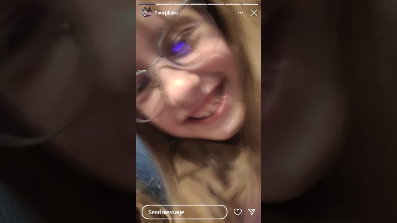 meet Leah-Nose. the weirdest nose around