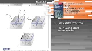 The Harriet Lane Handbook, 20th Edition screenshot 5