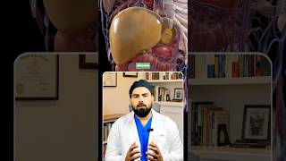 . Fatty Liver Without Alcohol? 😳 India’s Silent Disease Explained