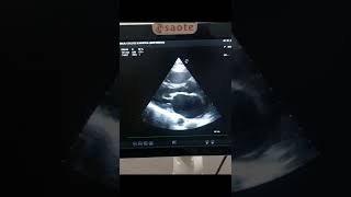echo cases/ case study