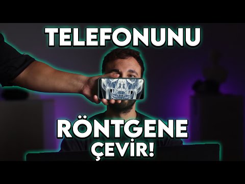 TELEFONDAN RÖNTGEN ÇEKME ! - Telefon Hileleri