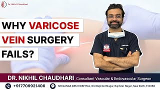 Why Varicose Vein Surgery Fails?  By Dr. Nikhil Chaudhari, Best Vascular Surgeon in Delhi