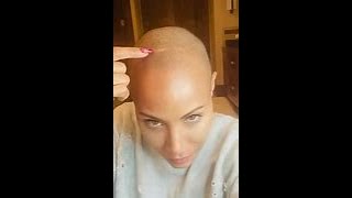 Jada Pinkett Smith, Alopecia and Why Representation Matters!!!