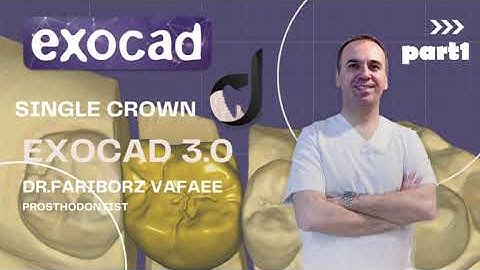 How to design single crown like a pro in exocad 3.0 (part1)