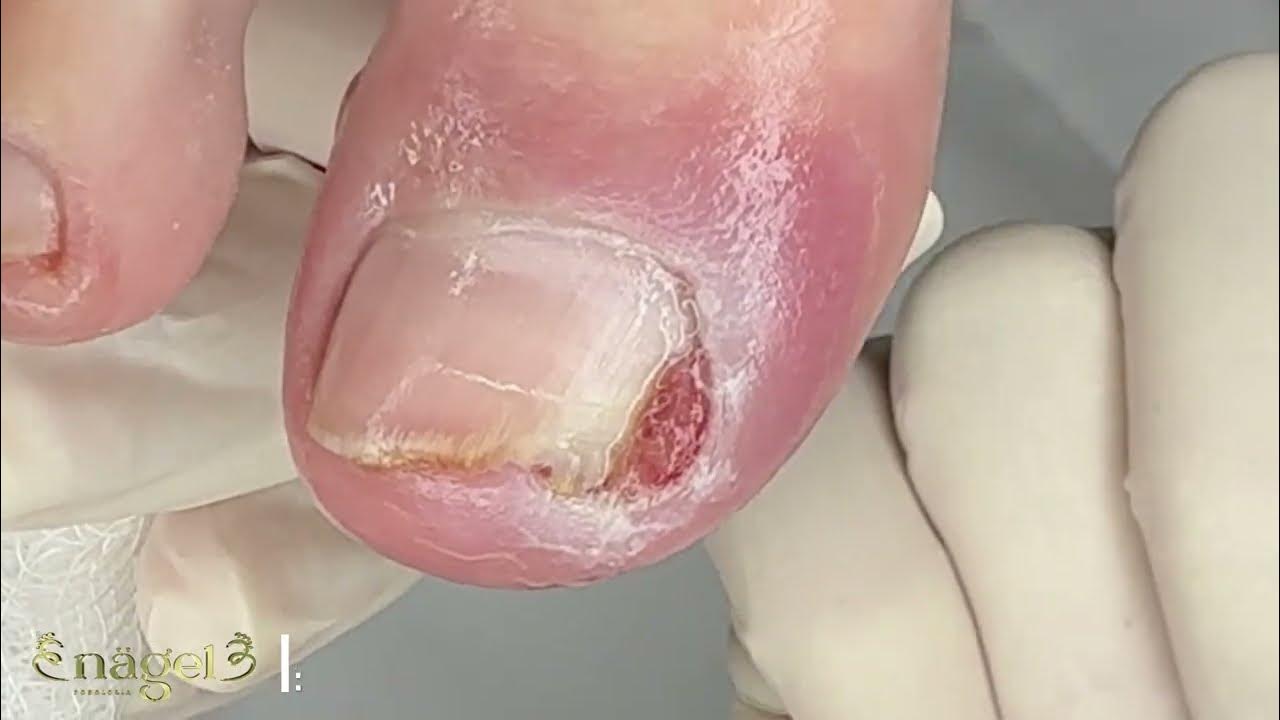 Yetuk ayollarning katta nipellari Labiyadagi ogirliklar