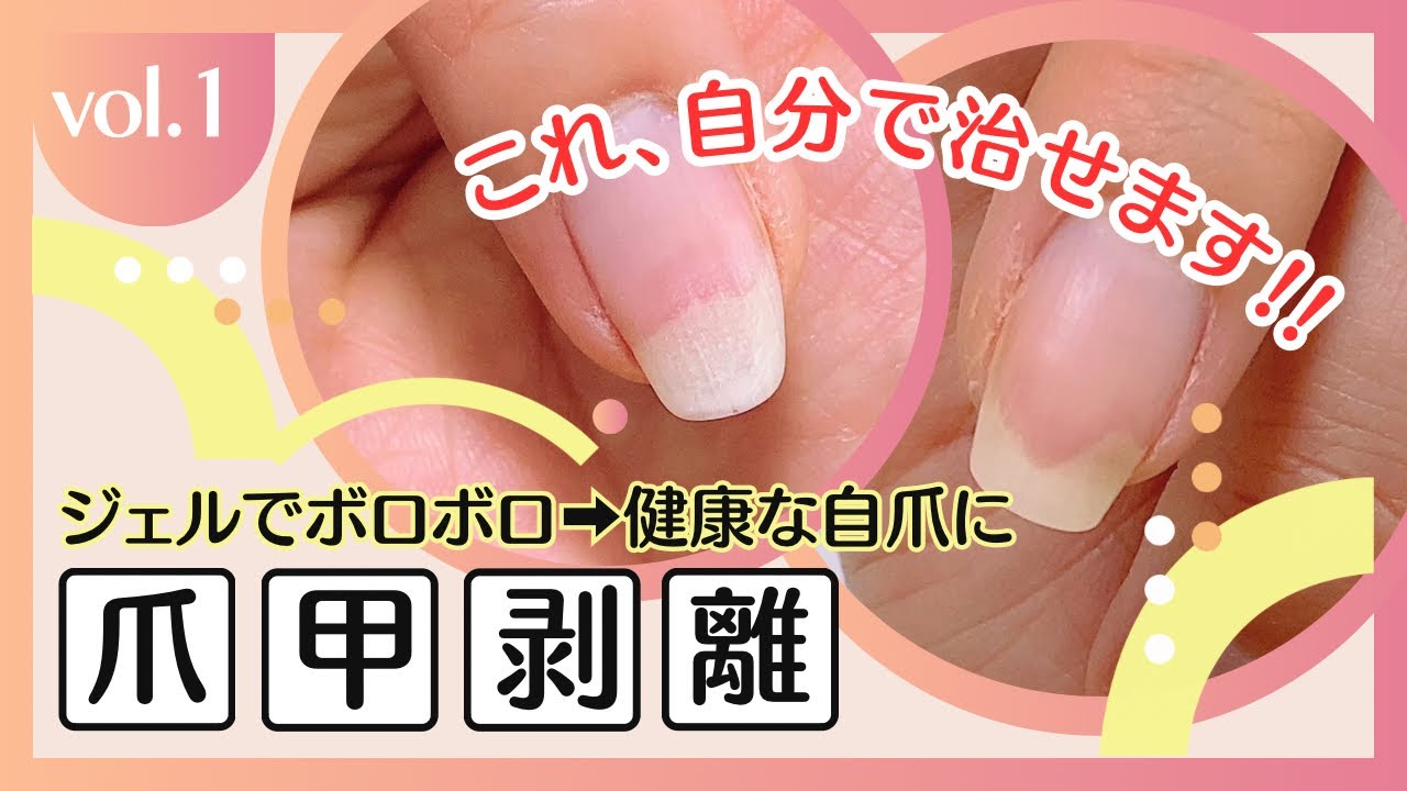 ジェルをやめて健康な自爪に戻したい人だけ見て！！