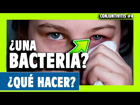 ▶️ CONJUNTIVTIS BACTERIANA: