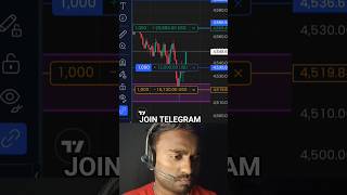 Live Profit in Forex Trading 😱||#forexsignals #shorts#trading#xauusd#goldtrading#shortsfeed#xauusd
