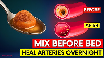 Mix These 3 Items Before Bed - It Heals Arteries While You Sleep