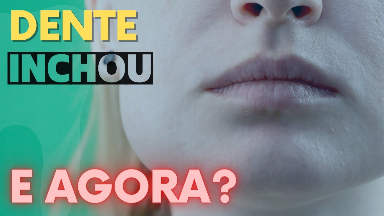 Dente inchado e doendo - O que fazer? - YouTube