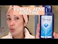 Treat Fungal Acne With This Skincare Routine | #SKINCARE