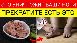 ОНЕМЕНИЕ В НОГАХ, СУДОРОГИ_ 6 продуктов, которые ВСЁ УСУГУБЛЯЮТ! - Фрэнк Суарес