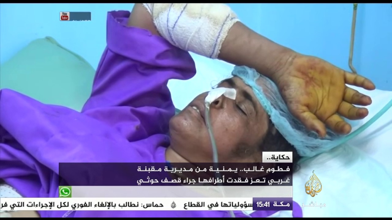 حكاية فطوم غالب.. يمنية فقدت أطرافها في تعز جراء قصف الحوثي