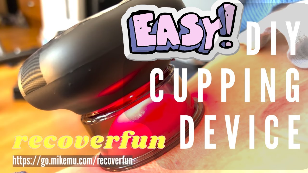Recoverfun Aircup Prime | An Auto Dynamic Cupping Anywhere Device