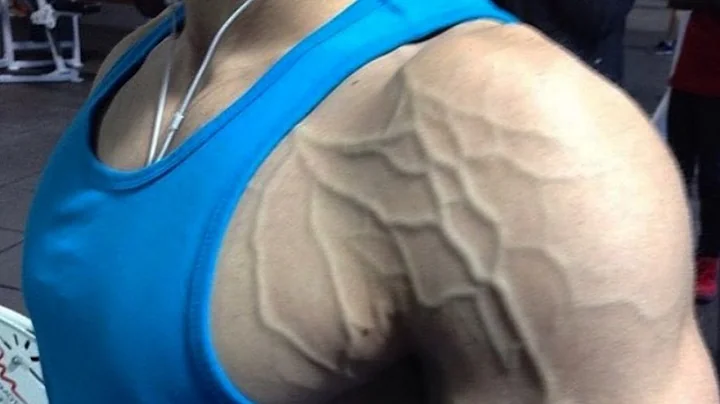 How To Increase Vascularity Naturally | Workout, Diet & Supplements to Become a Vascular Freak