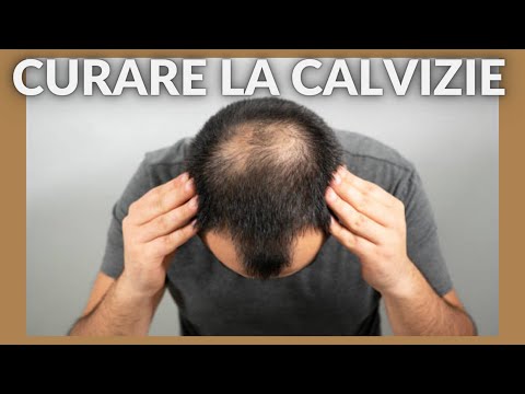 Video: Le fasce causano la caduta dei capelli?