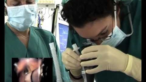 Airtraq Video Intubation Guide