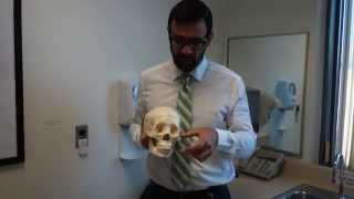 Measuring Facial Thirds - Potential VCA Donor