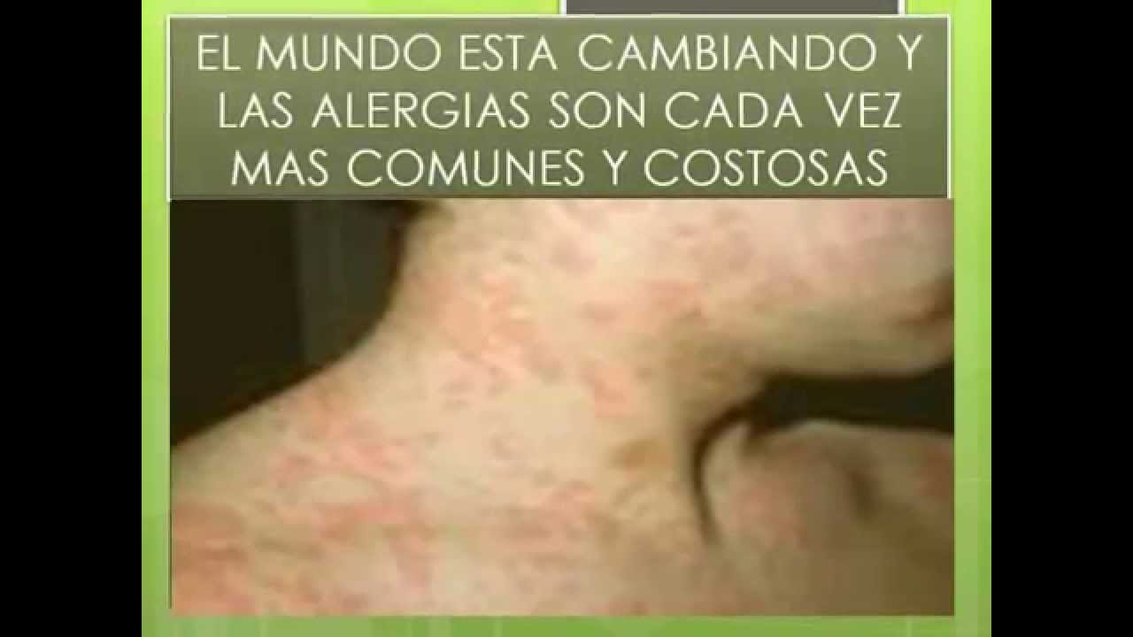 Leche alergia proteina vaca