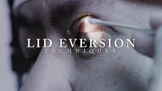 Ophthalmology: Lid Eversion Techniques #ubcmedicine