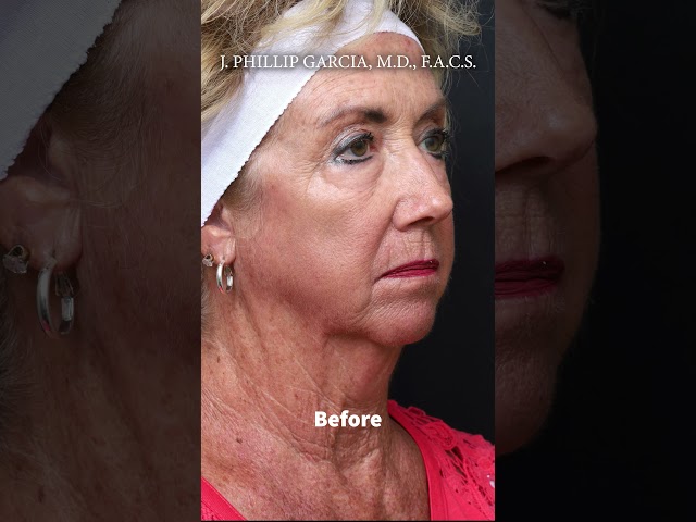 Beatrice's Transformation