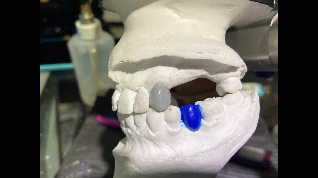 PRÁCTICA DE  ENCERADO DIAGNÓSTICO