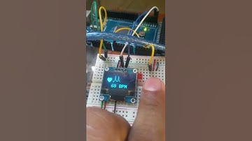 Medidor de Ritmo Cardíaco con Arduino