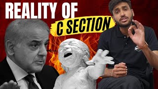 Why Is Rate Of C-Section Increasing? Adnan Nawaz
