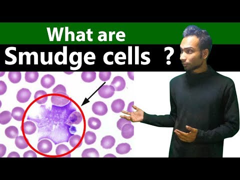 वीडियो: स्मज कोशिकाएं क्या दर्शाती हैं?