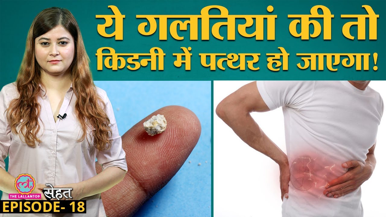 Doctors से जानिए, क्या करके Kidney Stones से बचा जा सकता है? Sehat Ep