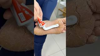 Just put toothpaste on your feet! Nail techs don’t want you to know this! Details