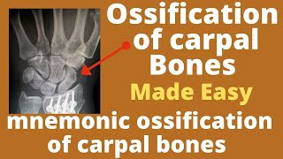 Carpal bones ossification | importance of ossification of carpal bones|Estimation of age from carpal