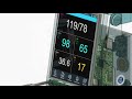Vital Sign Monitor V2
