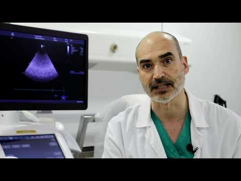 ECOCARDIOGRAMA DE ESFUERZO