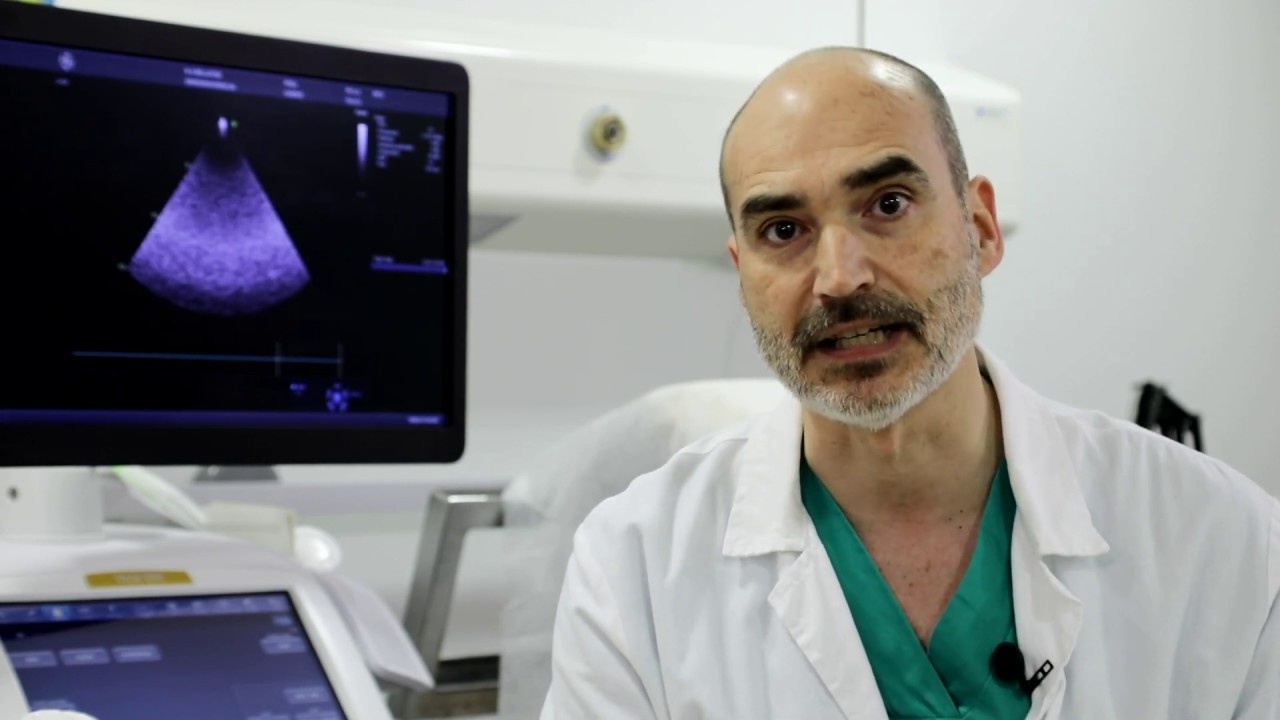 como se hace una ecografia de corazon