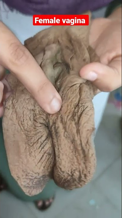 female vaginal structure for education 🤔 #shorts #education #medical #medicalstudent #vagina मे