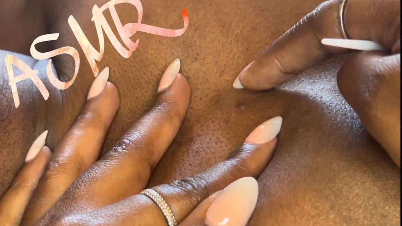 🤍ASMR🤍 BACK NITPICKING. Sleep Timer Starts Now ⏳😴💤