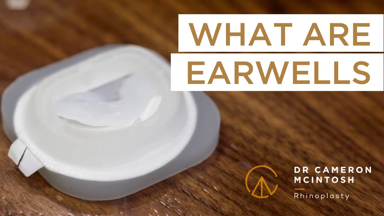 The EarWell Infant Ear correction system YouTube